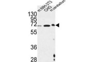 Western Blotting (WB) image for anti-Activating Transcription Factor 6 beta (ATF6B) antibody (ABIN3002237)