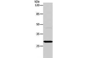 Western Blot analysis of Mouse liver tissue using CA1 Polyclonal Antibody at dilution of 1:450 (CA1 antibody)
