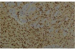 Immunohistochemistry of paraffin-embedded Mouse brain tissue using HIF1 bata Monoclonal Antibody at dilution of 1:200. (ARNT antibody)