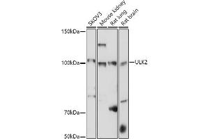 Western blot analysis of extracts of various cell lines, using ULK2 antibody (ABIN7271221) at 1:1000 dilution. (ULK2 antibody  (AA 1-100))