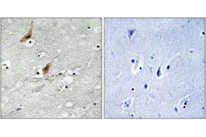 Immunohistochemical staining of paraffin-embedded human brain tissue reacted with RPS6KA4 (phospho T568) polyclonal antibody  at 1:50-1:100 dilution. (MSK2 antibody  (pThr568))