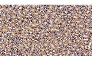 Detection of CBX3 in Mouse Kidney Tissue using Polyclonal Antibody to Chromobox Homolog 3 (CBX3) (CBX3 antibody  (AA 1-183))