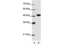 Image no. 1 for anti-Eukaryotic Translation Initiation Factor 4A2 (EIF4A2) (N-Term) antibody (ABIN6736193) (EIF4A2 antibody  (N-Term))