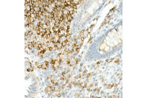 Immunohistochemistry of paraffin-embedded Human appendix using CD19 antibody (ABIN7266169) at dilution of 1:10000 (40x lens). (CD19 antibody)