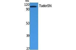 Western Blotting (WB) image for anti-Staphylococcal Nuclease Domain Containing Protein 1 (SND1) (Internal Region) antibody (ABIN3180975) (SND1 antibody  (Internal Region))