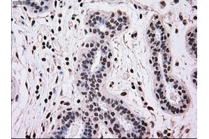 Immunohistochemical staining of paraffin-embedded breast tissue using anti-MRI1 mouse monoclonal antibody. (MRI1 antibody)