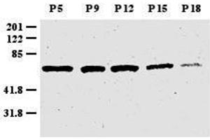 Anti-Zic1 Antibody - Western Blot. (ZIC1 antibody  (N-Term))