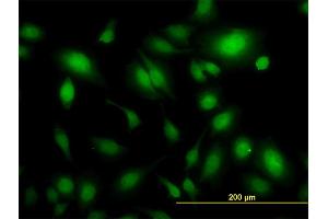 Immunofluorescence of monoclonal antibody to USP34 on HeLa cell. (USP34 antibody  (AA 3296-3395))