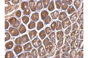 Immunohistochemistry (IHC) image for anti-Membrane Protein, Palmitoylated 6 (MAGUK P55 Subfamily Member 6) (MPP6) (N-Term) antibody (ABIN2856554)