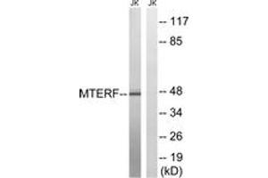 Western blot analysis of extracts from Jurkat cells, using MTERF Antibody. (MTERF antibody  (AA 267-316))