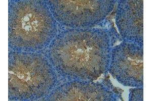 Detection of NOS2 in Mouse Testis Tissue using Polyclonal Antibody to Nitric Oxide Synthase 2, Inducible (NOS2) (NOS2 antibody  (AA 43-213))