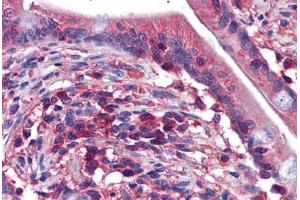 Human Small Intestine: Formalin-Fixed, Paraffin-Embedded (FFPE) (EDC4 antibody  (AA 1302-1402))