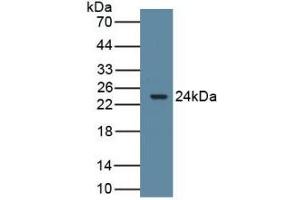 Detection of Recombinant ARO, Rat using Polyclonal Antibody to Aromatase (ARO) (Aromatase antibody  (AA 196-373))