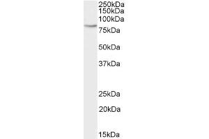 ABIN185583 (2µg/ml) staining of Daudi cell lysate (35µg protein in RIPA buffer). (GRK2 antibody  (Internal Region))