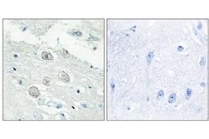 Immunohistochemistry analysis of paraffin-embedded human brain tissue, using JAK1 antibody.