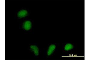 Immunofluorescence of purified MaxPab antibody to FLJ39378 on HeLa cell. (RILPL1 antibody  (AA 1-362))