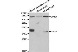 Western blot analysis of extracts of various cell lines, using BVES antibody (ABIN5970046) at 1/1000 dilution. (BVES antibody)
