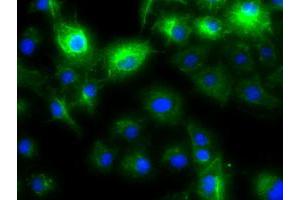 Anti-KRT8 mouse monoclonal antibody (ABIN2452366) immunofluorescent staining of COS7 cells transiently transfected by pCMV6-ENTRY KRT8 (RC209570). (KRT8 antibody  (AA 91-381))