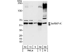Western Blotting (WB) image for anti-Heterogeneous Nuclear Ribonucleoprotein K (HNRNPK) (AA 300-350) antibody (ABIN7454659)