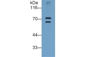 Detection of PADI6 in Human Placenta lysate using Monoclonal Antibody to Peptidyl Arginine Deiminase Type VI (PADI6) (PADI6 antibody  (AA 393-694))