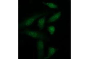 Image no. 2 for anti-Galectin 3 (LGALS3) antibody (ABIN1499247) (Galectin 3 antibody)