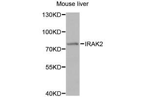 Western blot analysis of extracts of mouse liver, using IRAK2 antibody (ABIN1873258) at 1:1000 dilution. (IRAK2 antibody)