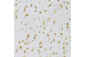 Immunohistochemistry of paraffin-embedded mouse brain using CBX8 Antibody (ABIN5973663) at dilution of 1/100 (40x lens). (CBX8 antibody)