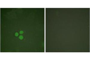 Immunofluorescence analysis of HeLa cells, treated with Forskolin (40nM, 30mins), using DP-1 antibody. (TGM4 antibody  (C-Term))