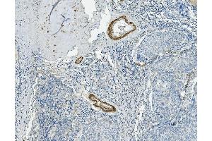 IHC analysis of VCL using anti-VCL antibody (ABIN7599003). (Vinculin antibody  (AA 1-149))