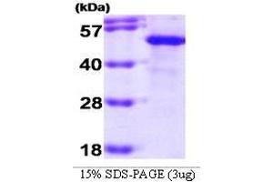 Figure annotation denotes ug of protein loaded and % gel used. (HSC70 Interacting Protein HIP Protein (AA 1-369))