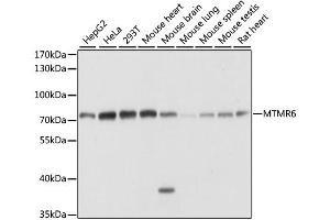 Western blot analysis of extracts of various cell lines, using MTMR6 antibody. (MTMR6 antibody)