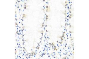 Immunohistochemistry of paraffin-embedded human colon using BRMS1 antibody (ABIN7265929) at dilution of 1:100 (40x lens).