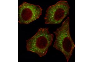 Fluorescent image of U251 cell stained with CACNA2D2 Antibody . (CACNA2D2 antibody  (AA 643-671))