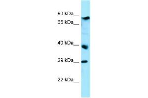 WB Suggested Anti-BRAT1 Antibody Titration: 1. (BAAT1 antibody  (C-Term))