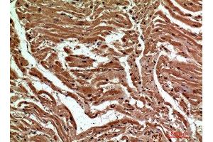 Immunohistochemical analysis of paraffin-embedded human-heart, antibody was diluted at 1:200 (C-Type Lectin Domain Family 6, Member A (CLEC6A) (Internal Region) antibody)
