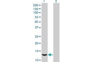 Western Blot analysis of HSPC152 expression in transfected 293T cell line by HSPC152 monoclonal antibody (M09), clone 3E5.