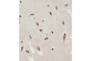 Immunohistochemical analysis of paraffin-embedded H. (C13orf30 antibody  (C-Term))