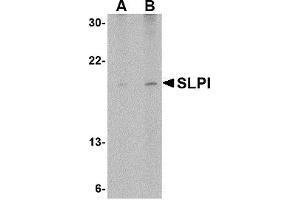 Western Blotting (WB) image for anti-Secretory Leukocyte Peptidase Inhibitor (SLPI) (Middle Region) antibody (ABIN1031101) (SLPI antibody  (Middle Region))