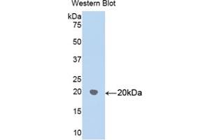 Western blot analysis of recombinant Human HSPD1. (HSPD1 antibody  (AA 172-343))