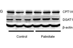 Western Blotting (WB) image for anti-Diacylglycerol O-Acyltransferase 1 (DGAT1) (AA 200-300) antibody (ABIN6139556)