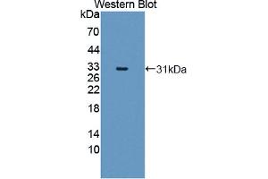Figure. (MYL6B antibody  (AA 5-199))