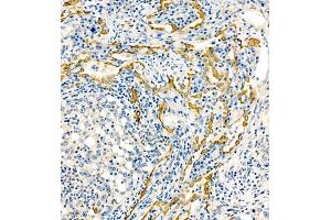 MRP1 antibody