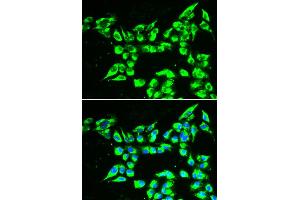 Immunofluorescence analysis of A549 cell using KLK10 antibody. (Kallikrein 10 antibody)