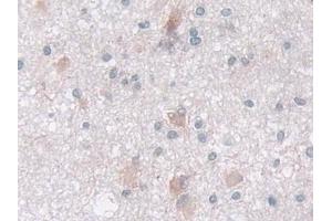 Immunohistochemistry (IHC) image for anti-Isocitrate Dehydrogenase 2 (NADP+), Mitochondrial (IDH2) (AA 40-452) antibody (ABIN7441520)
