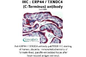 Image no. 2 for anti-Endoplasmic Reticulum Protein 44 (ERP44) (C-Term) antibody (ABIN1734140)