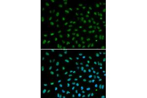 Immunofluorescence analysis of MCF-7 cells using DDB2 antibody (ABIN5970947). (DDB2 antibody)