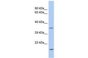 ASPDH antibody  (AA 143-192)