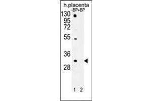 Western blot analysis of OR1D5 Antibody (C-term) Cat.