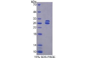 Image no. 1 for ATP-Binding Cassette, Sub-Family G (WHITE), Member 5 (ABCG5) (AA 66-276) protein (His tag) (ABIN4989934) (ABCG5 Protein (AA 66-276) (His tag))