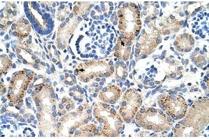 Rabbit Anti-MUC1 Antibody ,Paraffin Embedded Tissue: Human Kidney  Cellular Data: Epithelial cells of renal tubule  Antibody Concentration: 4. (MUC1 antibody  (C-Term))